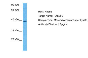RASSF2 Rabbit Polyclonal Antibody