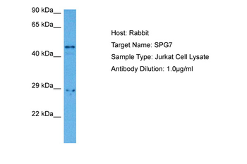 SPG7 Rabbit Polyclonal Antibody