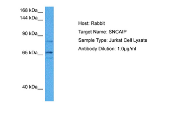 SNCAIP Rabbit Polyclonal Antibody