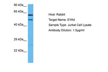 EYA4 Rabbit Polyclonal Antibody