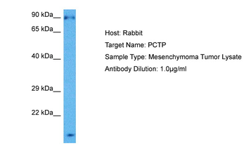PCTP Rabbit Polyclonal Antibody