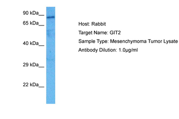 GIT2 Rabbit Polyclonal Antibody
