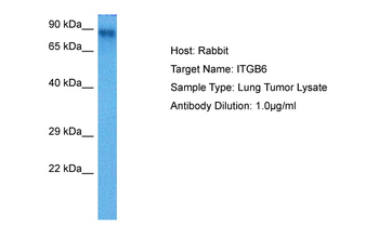 ITGB6 Rabbit Polyclonal Antibody