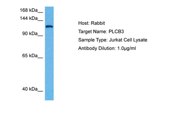 PLCB3 Rabbit Polyclonal Antibody