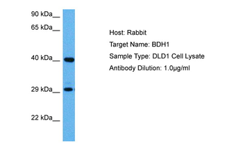 BDH1 Rabbit Polyclonal Antibody