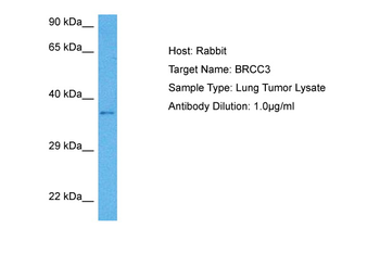 BRCC3 Rabbit Polyclonal Antibody