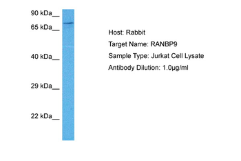 RANBP9 Rabbit Polyclonal Antibody