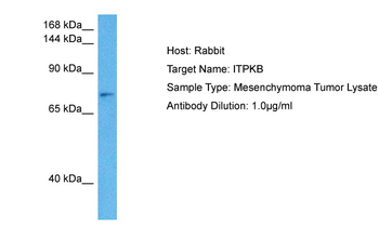 ITPKB Rabbit Polyclonal Antibody