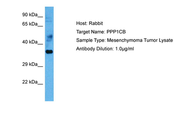 PPP1CB Rabbit Polyclonal Antibody
