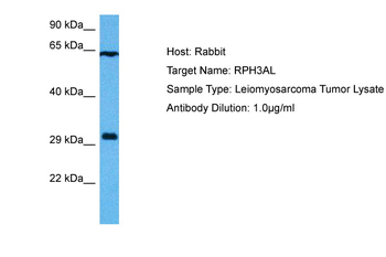 RPH3AL Rabbit Polyclonal Antibody