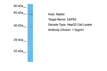 CEP63 Rabbit Polyclonal Antibody