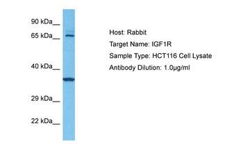 IGF1R Rabbit Polyclonal Antibody
