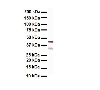 KRT15 Rabbit Polyclonal Antibody