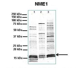 NME1 Rabbit Polyclonal Antibody