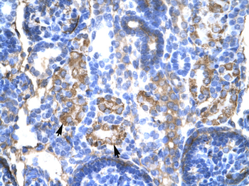 SERPINA1 Rabbit Polyclonal Antibody