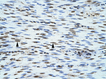 NLRC4 Rabbit Polyclonal Antibody