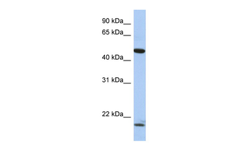 PLAGL1 Rabbit Polyclonal Antibody