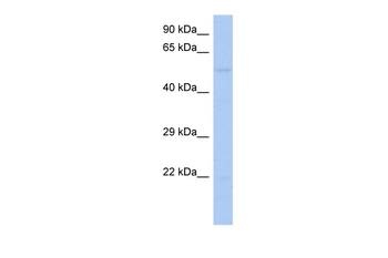 RIPK3 Rabbit Polyclonal Antibody