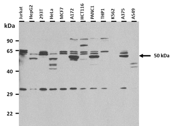 TNFRSF1A Rabbit Polyclonal Antibody