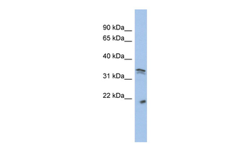 CDC2 Rabbit Polyclonal Antibody