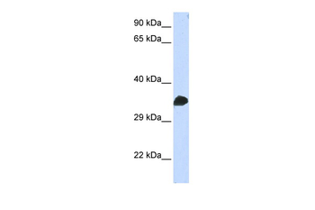 CDC2 Rabbit Polyclonal Antibody
