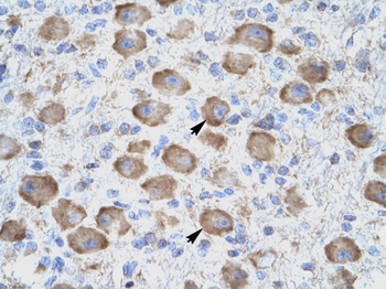 TNFRSF18 Rabbit Polyclonal Antibody
