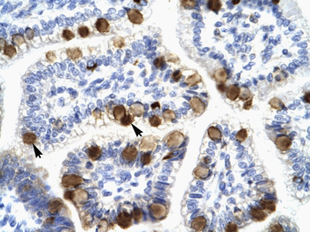 YWHAH Rabbit Polyclonal Antibody
