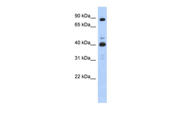 CDK9 Rabbit Polyclonal Antibody