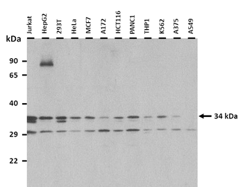 CDK2 Rabbit Polyclonal Antibody