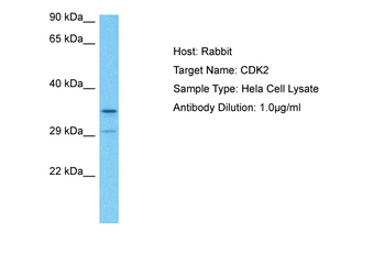 CDK2 Rabbit Polyclonal Antibody