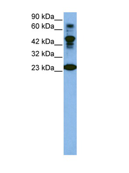 CDK2 Rabbit Polyclonal Antibody