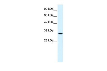 CDC2 Rabbit Polyclonal Antibody