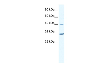 CCND3 Rabbit Polyclonal Antibody
