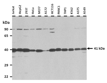 FOS Rabbit Polyclonal Antibody