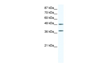 MAPK14 Rabbit Polyclonal Antibody