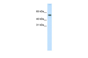AKT1 Rabbit Polyclonal Antibody
