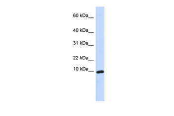 CXCL9 Rabbit Polyclonal Antibody