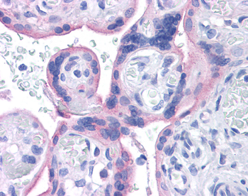 INSR Rabbit Polyclonal Antibody