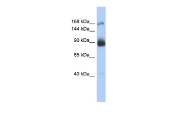 INSR Rabbit Polyclonal Antibody