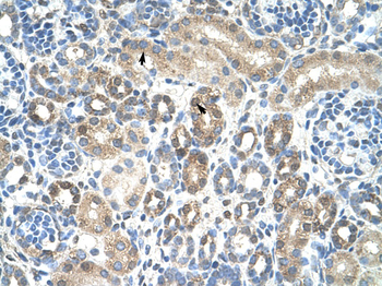 CAV1 Rabbit Polyclonal Antibody