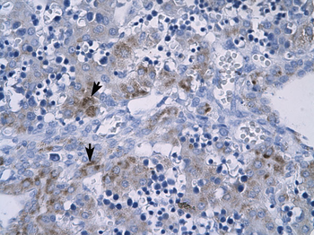 RGS9 Rabbit Polyclonal Antibody