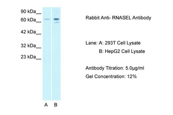 RNASEL Rabbit Polyclonal Antibody