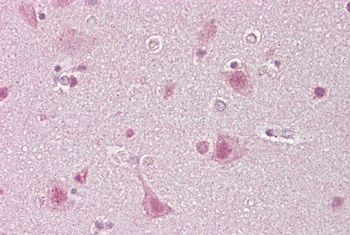SREBF1 Rabbit Polyclonal Antibody