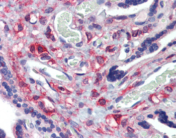 KIF20A Rabbit Polyclonal Antibody