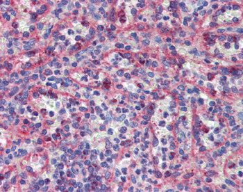 KIF20A Rabbit Polyclonal Antibody