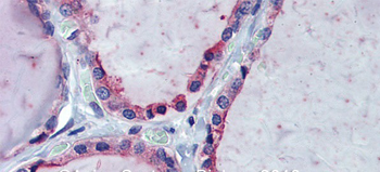 KIF20A Rabbit Polyclonal Antibody