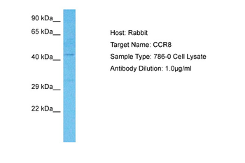 CCR8 Rabbit Polyclonal Antibody