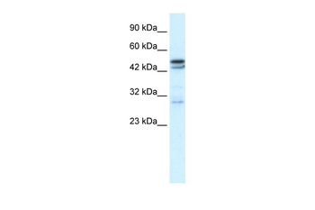 CHRNA3 Rabbit Polyclonal Antibody
