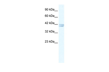 CHRNA7 Rabbit Polyclonal Antibody