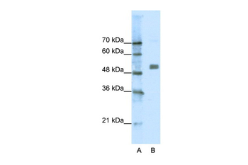 CHRNA9 Rabbit Polyclonal Antibody